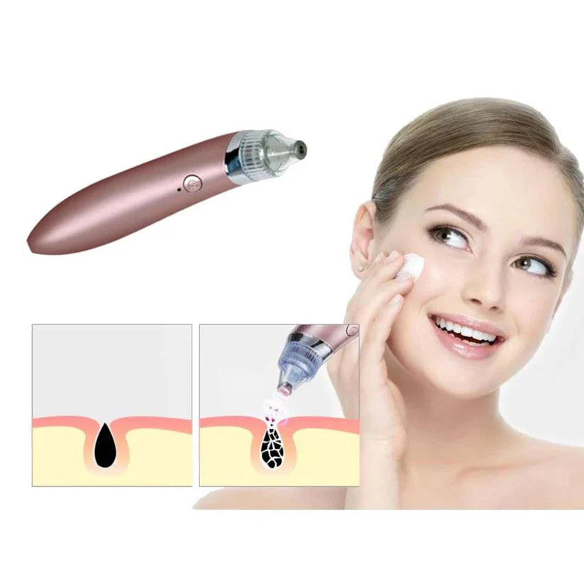 Blackhead Remover, Vacuum Cleaner Pore Skin Care Tool Machine 5 stars